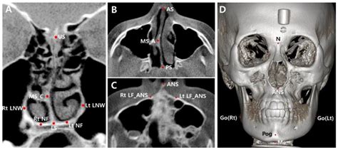 Applied Sciences Free Full Text A CBCT Evaluation Of Nasal Septal