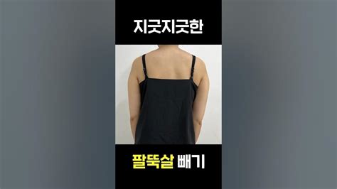 지긋지긋한 팔뚝살🙄 어떻게 변할까⁉️ 지방흡입 지방흡입후기 Shorts Youtube