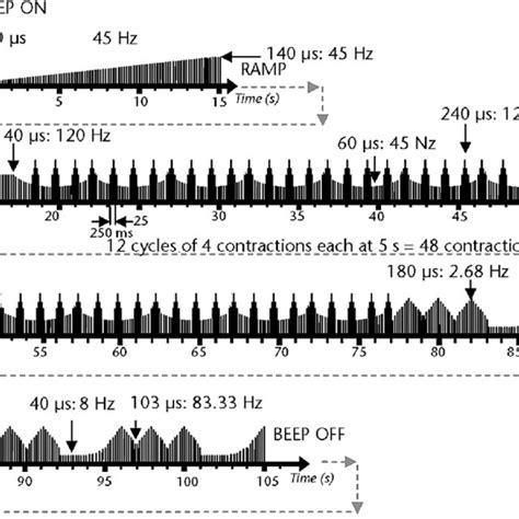 Diagram Of Electrical Stimulation Pattern With A Low Voltage