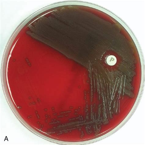 Bacteriology Clinical Tree