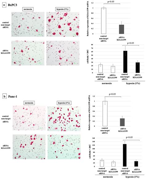 Cell Migratory Ability Of Pdac Cells Under Hypoxia Withwithout