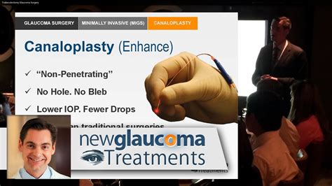 Canaloplasty Minimally Invasive Glaucoma Surgery YouTube