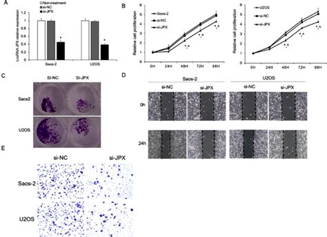 JPX Knockdown Inhibited Saos 2 And U2OS Cell Proliferation Migration