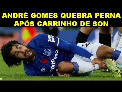 CENAS FORTES ANDRÉ GOMES QUEBRA PERNA APÓS CARRINHO DE SON QUE FICA