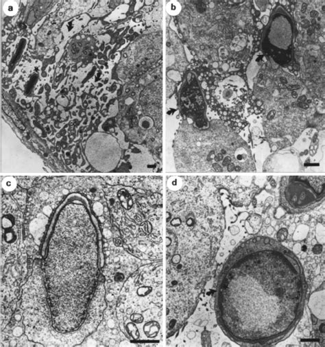 Electron Micrograph Of Seminiferous Tubules And Spermatids Of Mtp53 94