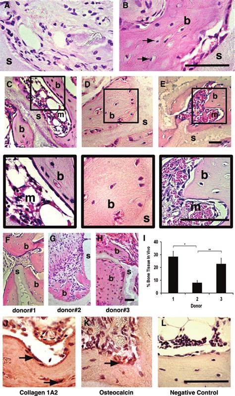 In Vivo Bone Forming Potential Photomicrographs Of Decalcified