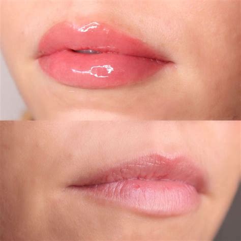 MontrÉal Freckles Tattoo Pmu On Instagram Lip Blush First Session