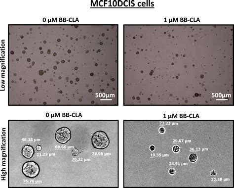 Utilization Of The Soft Agar Colony Formation Assay To Identify Inhibitors Of Tumorigenicity In