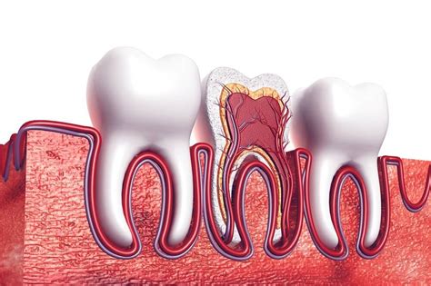 Root Canal Complete with Crown, Otherwise Treatment just isn't Complete