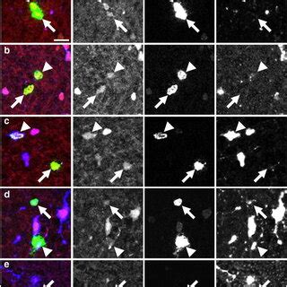 Three Dimensional Images Of Gst Pi Dm Mrna Expression Patterns Among