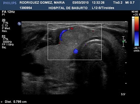 Transductores Atelpv Cursos