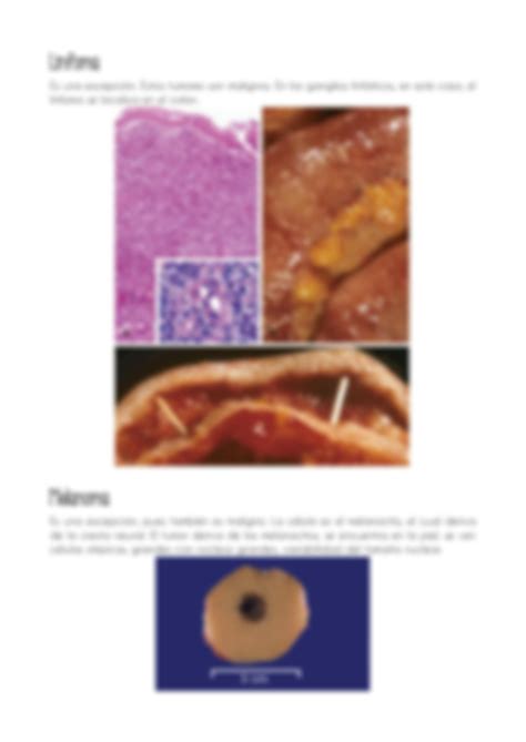 Solution Nomenclatura De Las Neoplasias Studypool