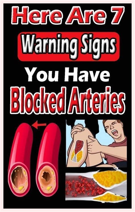 7 Signs That Your Arteries Are Blocked And How Artofit