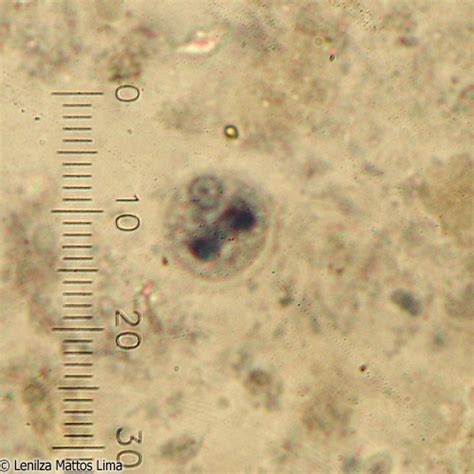 Cistos De Entamoeba Histolytica E Dispar Fotografias Microscópicas E Macroscópicas Atlas