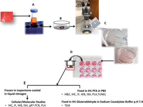 Frontiers Human Organ Culture Updating The Approach To Bridge The