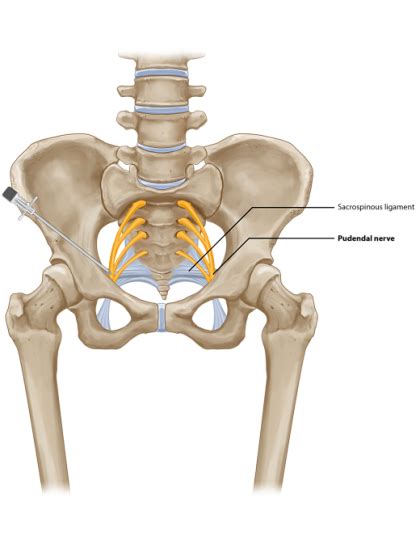 Pudendal Nerve Block Pain Spa