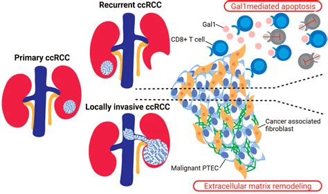 Frontiers Cellular Milieu In Clear Cell Renal Cell Carcinoma