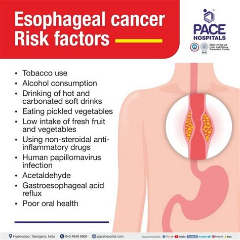 Esophageal Cancer Symptoms Causes Complications Prevention