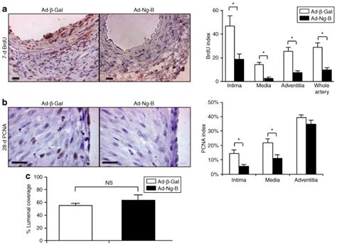 Ad Ng B Blocks Vascular Smooth Muscle Cell Proliferation In Vivo The