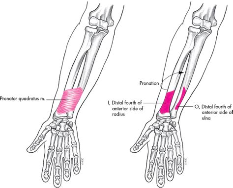 Pronator quadratus is a square muscle on the distal forearm, with ...