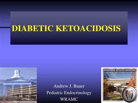 Ppt Diabetic Ketoacidosis Powerpoint Presentation Free Download Id