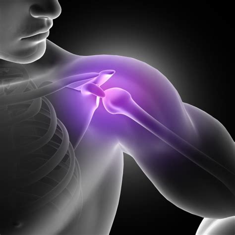 Shoulder Impingement Syndrome: Causes, Symptoms & Treatment Explained – Dr Sumit Badhwar