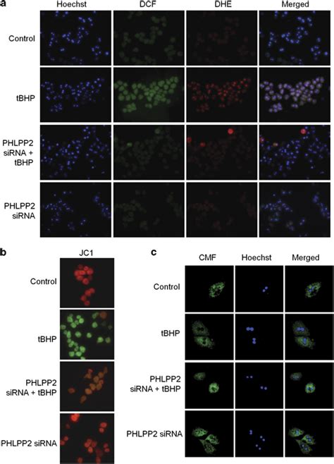 Phlpp Silencing Prevents Tbhp Induced Oxidative Stress Normal And