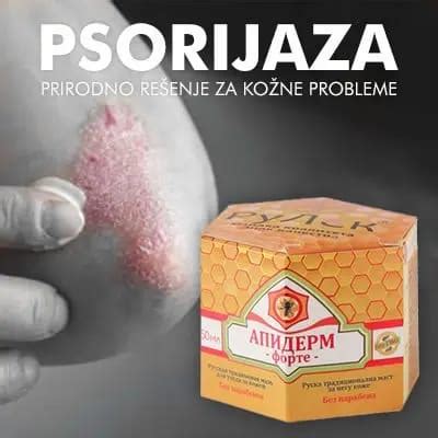 Kako Lijeciti Psorijazu Prirodnim Putem