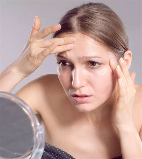 How To Get Rid Of Oily Skin 10 Effective Home Remedies Prevention Tips