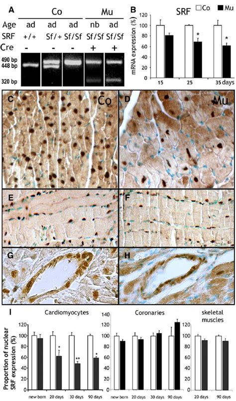 Analysis Of Srf Expression In Desmin Cre Sf Sf Mice A Pcr Of Genomic