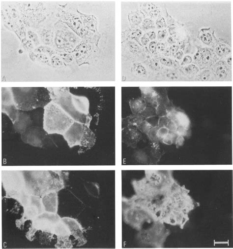 Phase Contrast And Fluorescence Images Of A431 Cells Double Labeled