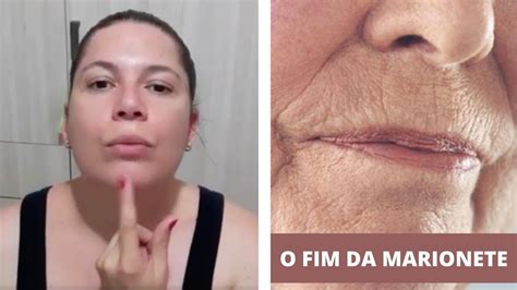 Como Eliminar Rugas De Marionete Rugas Na Boca Bigode Chin S C Digo