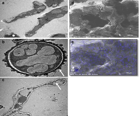 Transmission Electron Microscopic Tem View Of Cross Sections Of