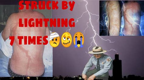 Struck By Lightning 7 Times And Survivedroy Sullivan Youtube