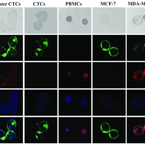 Quadruple Immunostaining Of Pbmcs Ctcs And Breast Cancer Cells