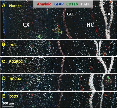 Immunofluorescent Labeling Of Amyloid And Glia Cells The Images Show