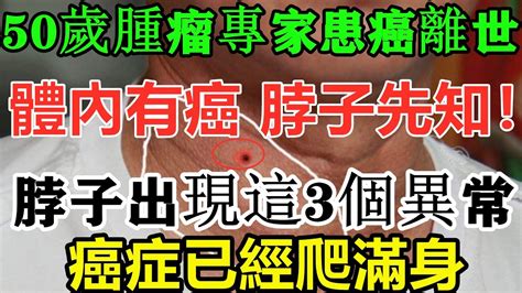 50歲腫瘤專家患癌離世，臨終前反思：體內有癌脖子先知！脖子上出現這3個信號，可能是癌症已纏上你了！千萬要警惕 Youtube