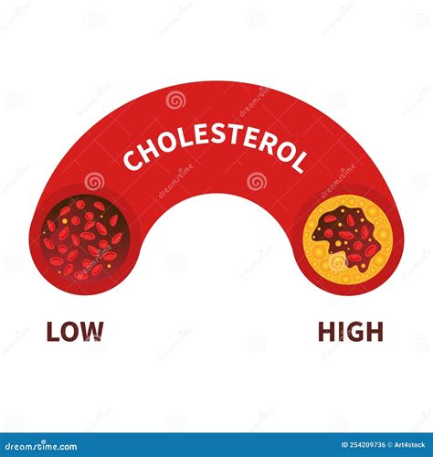 Cholesterol Level Meter Gauge With Blood Vessel Diagram Stock Vector