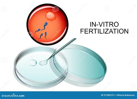 In Vitro Fertilization Stock Vector Illustration Of Donor 97300375