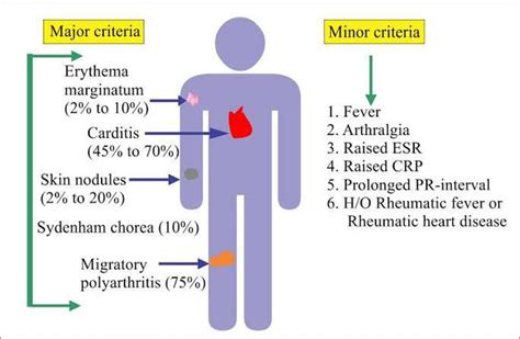 Rheumatic Fever Medizzy