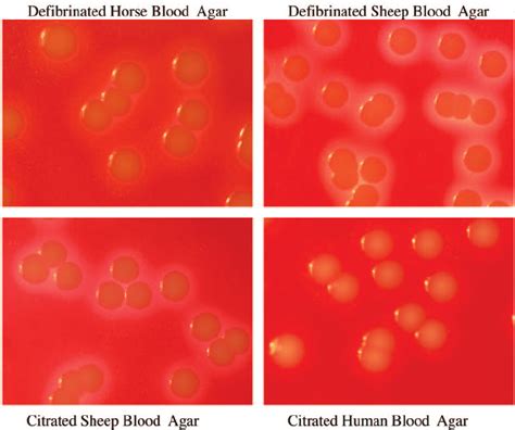 Growth Of S Aureus Atcc On The Four Different Blood Agars At A