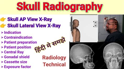 Skull Radiography Skull Ap View Skull Lateral View X Ray Patient