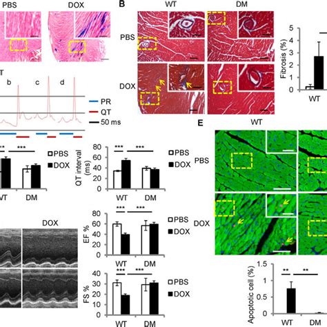 Changes In Mitochondrial Function And Structure After Acute Doxorubicin