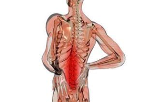 Qué es el síndrome de dolor facetario lumbar Las principales claves