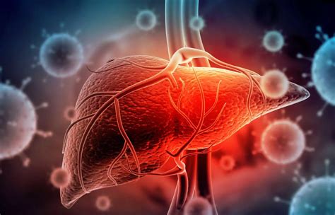 Hepatite viral principais tipos sintomas e tratamento da doença