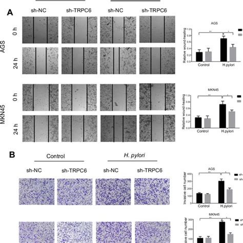 Wnt β catenin TRPC6 signaling is involved in H pylori induced gastric