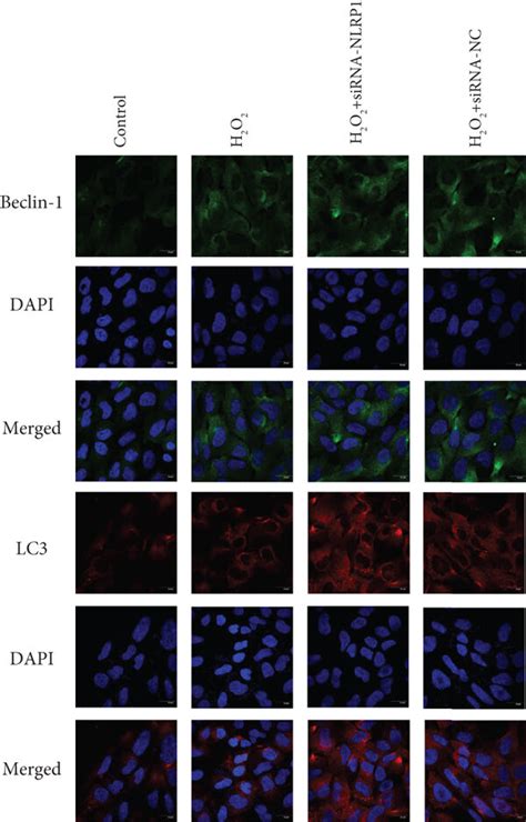 Autophagy Related Protein Expression In An HTR 8 SVneo Cell Oxidative