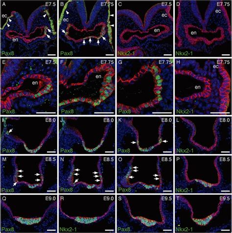 Pax8 And Nkx2 1 Expression During Mouse Foregut Morphogenesis A D