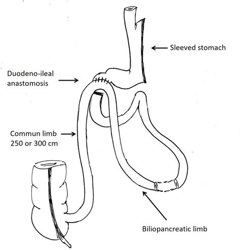 Prospective Multicentre Randomised Trial Comparing The Efficacy And