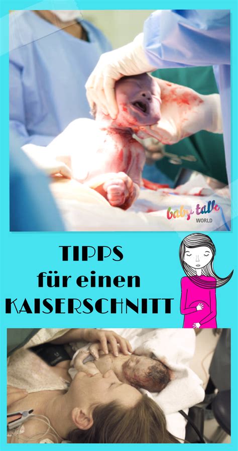 Kaiserschnitt Tipps F R Eine Kaiserschnitt Geburt Babytalk World